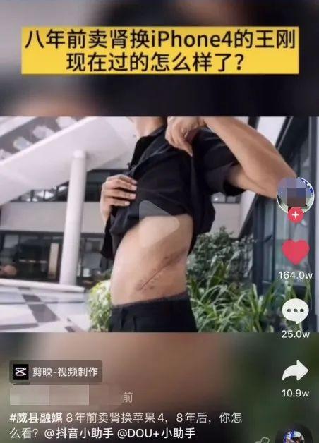 9年了，那个卖肾买苹果手机的17岁年轻人，现在怎么样了？