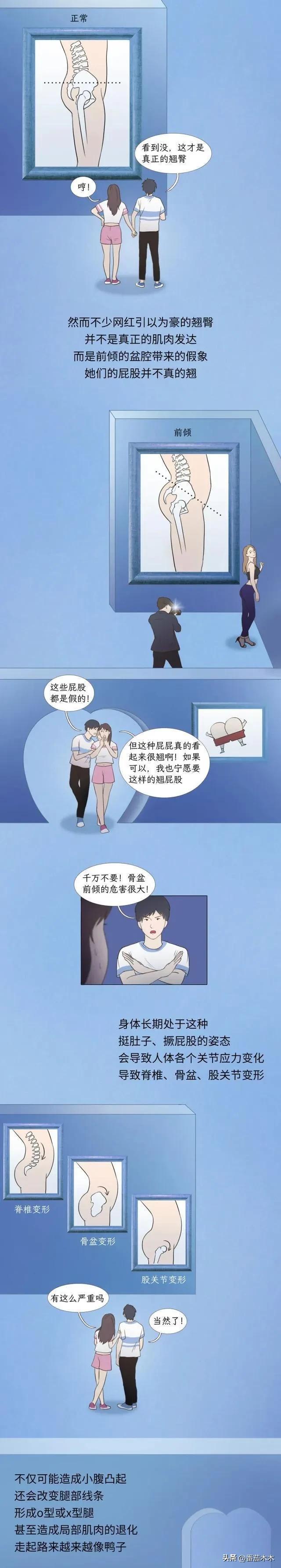 漫画讲述：女生臀部太“翘”，究竟有多危险？爱美，要付出代价！